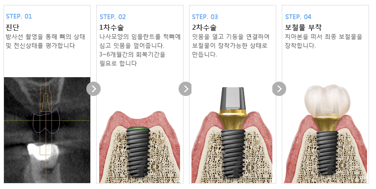 이미지명